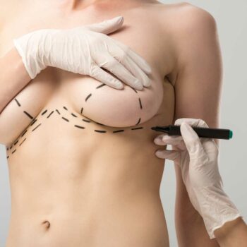 Breast Lifting