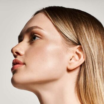 Chin Reduction