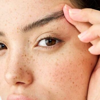 Eyebrow Lift