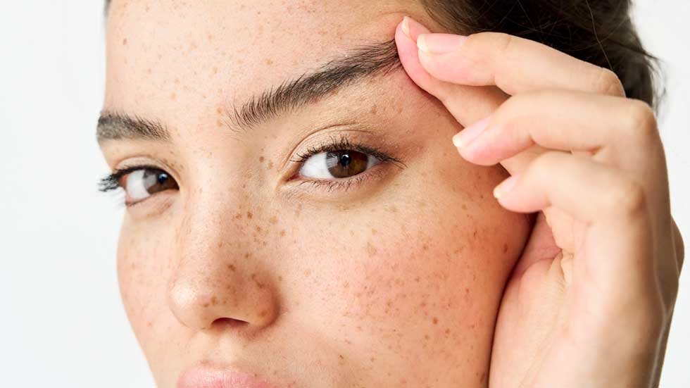 Eyebrow Lift