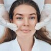 Mid-Face Lift Surgery