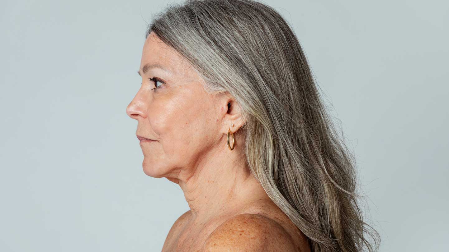 Neck Lift Extended