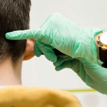 Otoplasty
