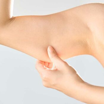 Arm Lift & Lipo