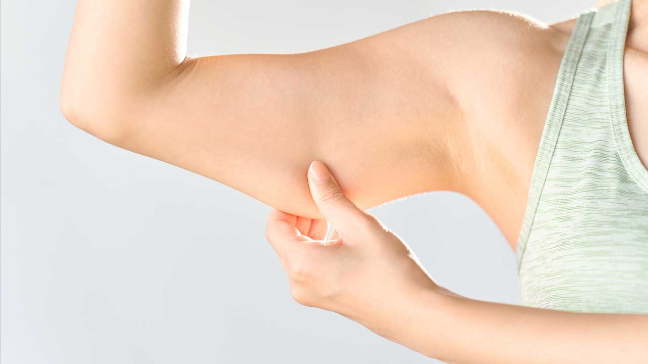 Arm Lift & Lipo
