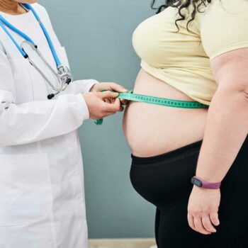 Bariatric Surgery