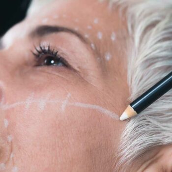 deep plane facelift