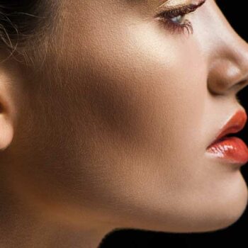 Chin Implant