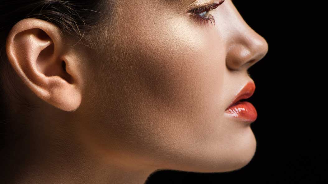 Chin Implant